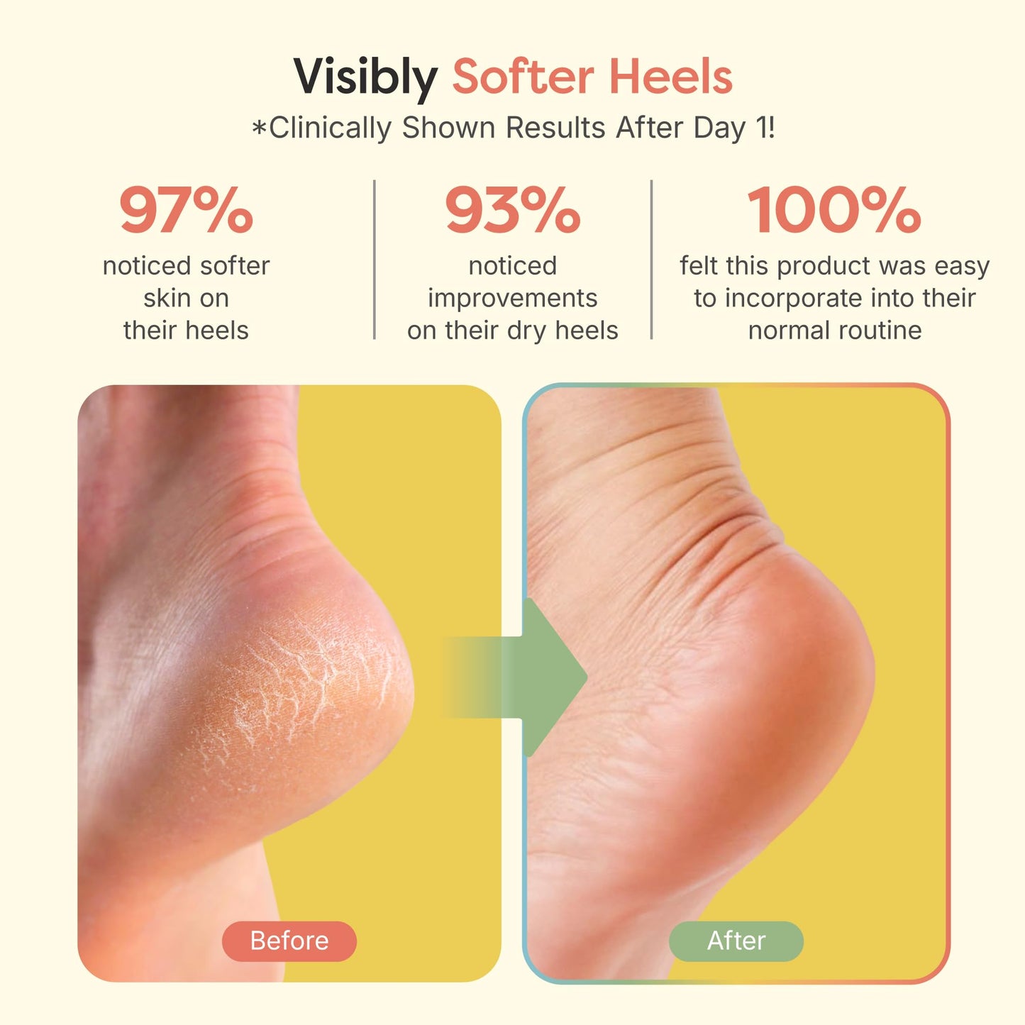ZenToes Moisturizing Socks for Cracked Heel Treatment, Vitamin E, Olive Oil and Jojoba Oil Infused Heel Socks, Spa Gifts for Women, Mothers Day Gifts (Fuzzy Lilac Purple, Regular)